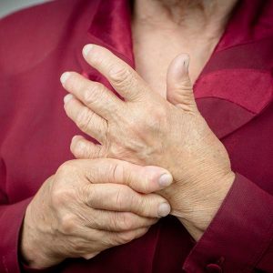 Rheumatoid Arthritis Treatment